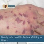 Deadly Infection Kills 14-Year-Old Boy in Hours