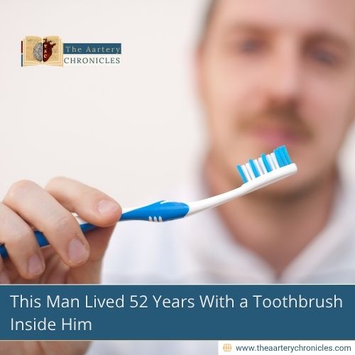 This Man Lived 52 Years With a Toothbrush Inside Him