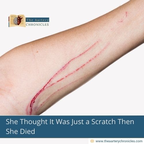 She Thought It Was Just a Scratch Then She Died