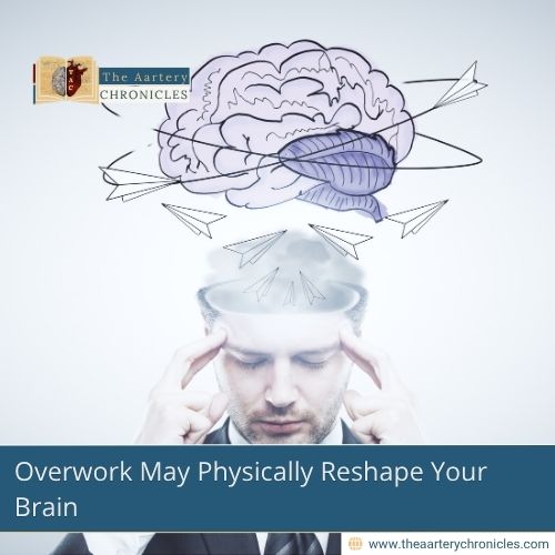 is-your-job-changing-your-brain-scientists-say-yes-the-aartery-chronicles-tac