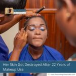 Her Skin Got Destroyed After 22 Years of Makeup Use