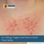 Sun-Allergy-Triggers-and-How-to-Avoid-Them-Safely-The-Aartery-Chronicles-TAC