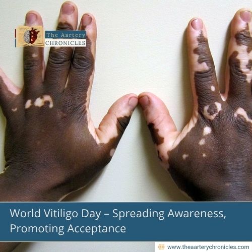 World-Vitiligo-Day -Spreading-Awareness,-Promoting-Acceptance-The-Aartery-Chronicles-TAC