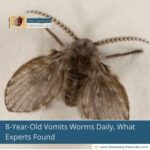 8-Year-Old Vomits Worms Daily, What Experts Found