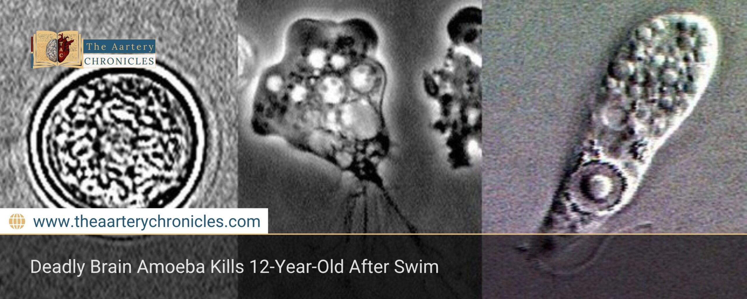 Deadly Brain Amoeba Kills 12-Year-Old After Swim