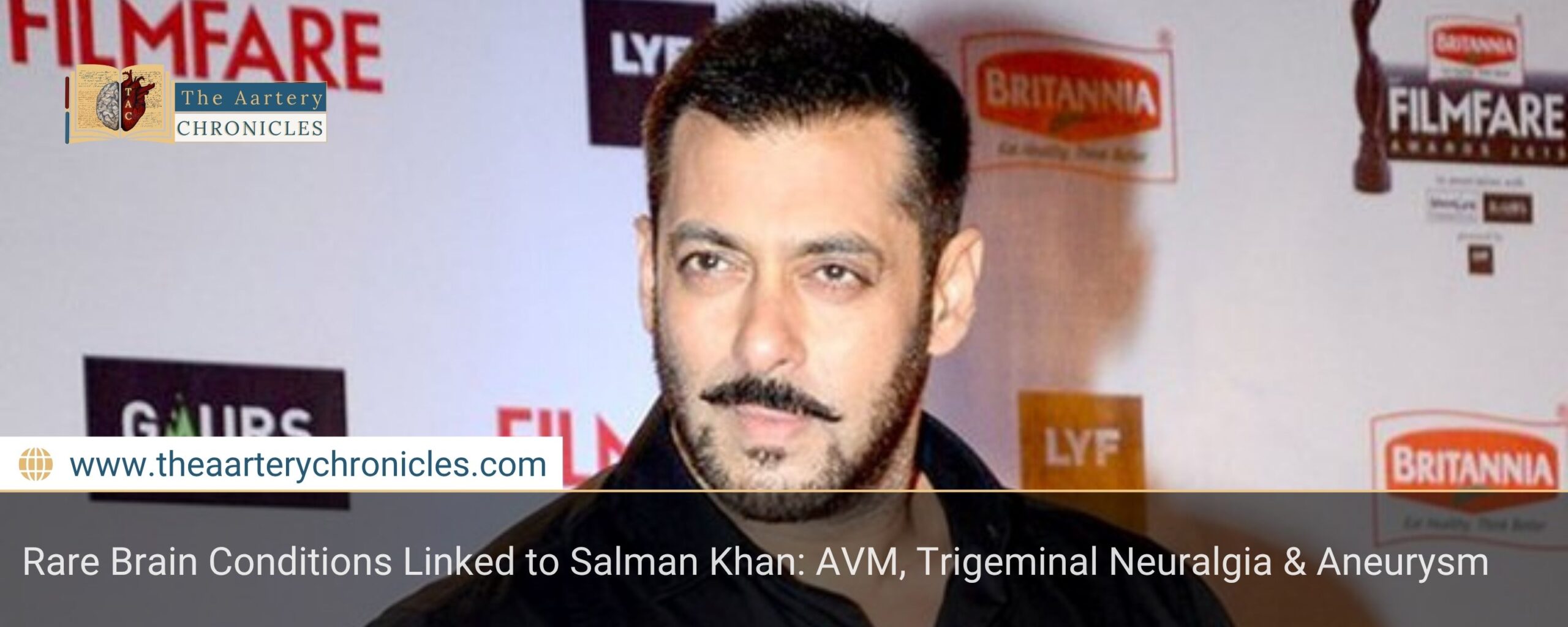 salman-khan-and-rare-brain-conditions-everything-you-need-to-know-the-aartery-chronicles-tac