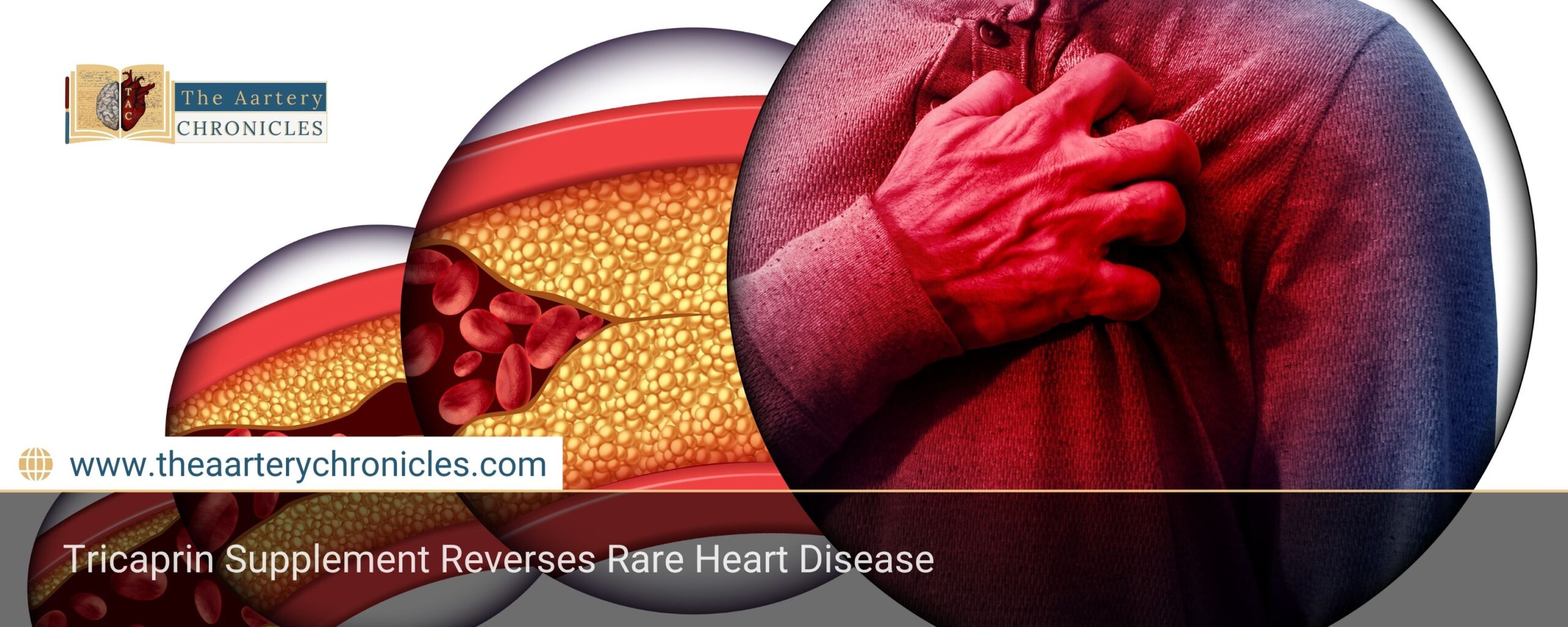 tricaprin-supplement-reverses-rare-heart-disease-a-groundbreaking-discovery-the-aartery-chronicles-tac