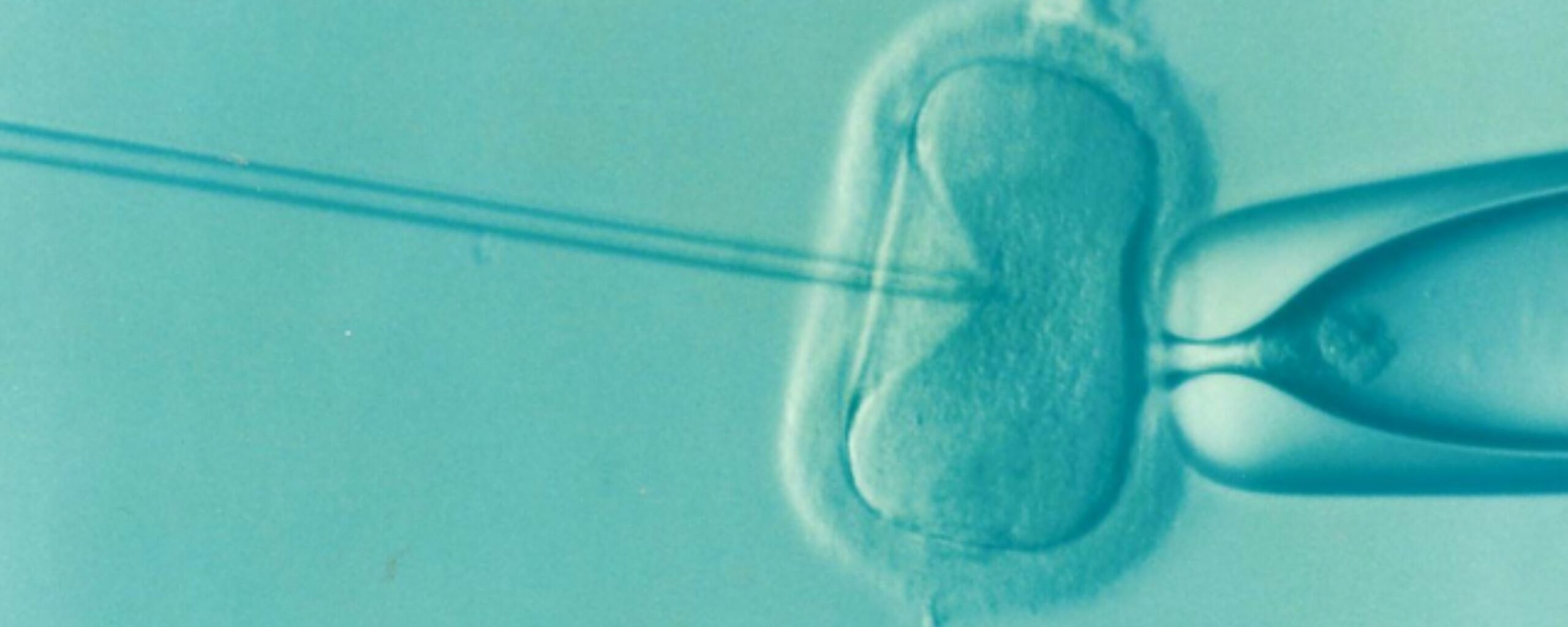 world-ivf-day-a-scientific-milestone-in-reproductive-medicine-the-aartery-chronicles-tac