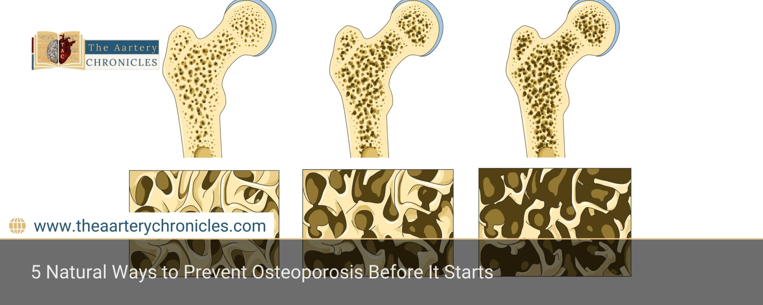 5-natural-ways-to-prevent-osteoporosis-before-it-starts-the-aartery-chronicles-tac