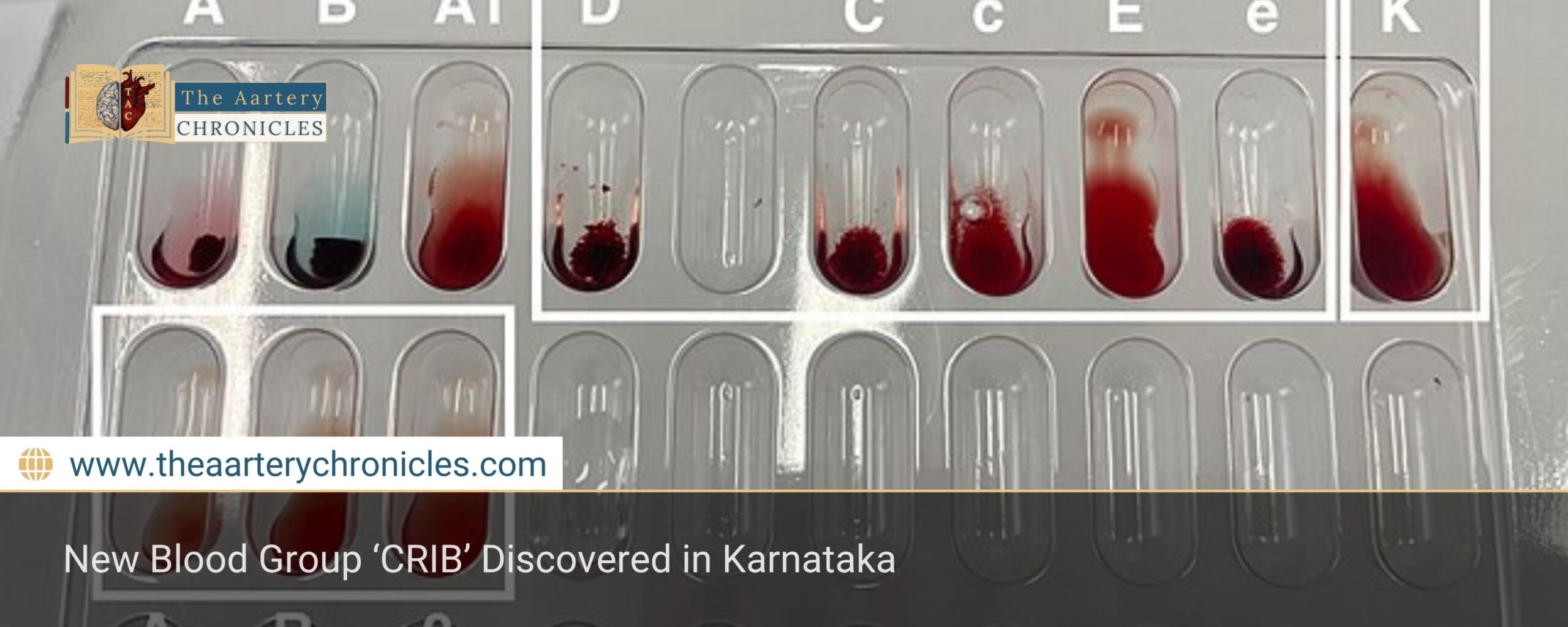 New Blood Group ‘CRIB’ Discovered in Karnataka
