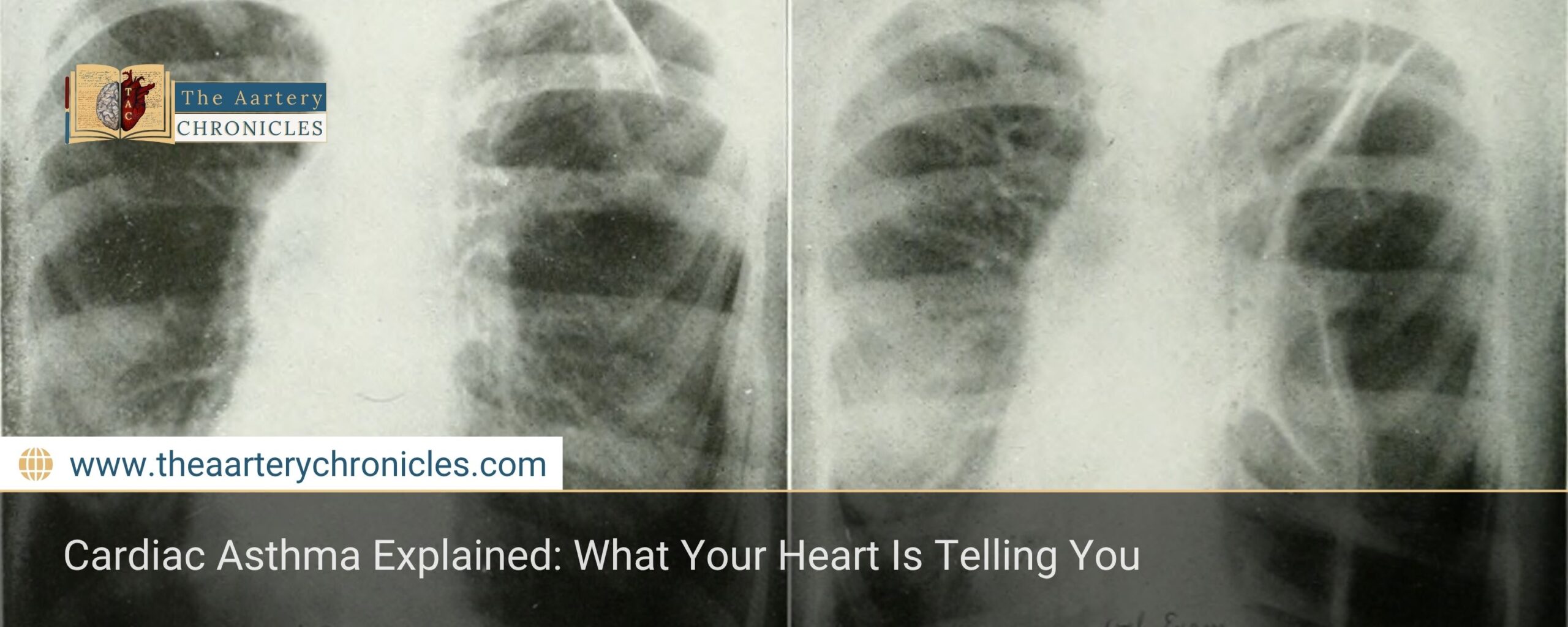 Cardiac-Asthma-Explained:-What-Your-Heart-Is-Telling-You-The-Aartery-Chronicles-TAC