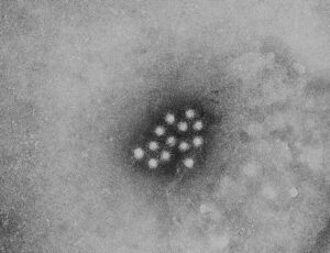 Hepatitis A virus