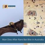 Man Dies After Rare Bat Bite in Australia