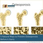 5-natural-ways-to-prevent-osteoporosis-before-it-starts-the-aartery-chronicles-tac