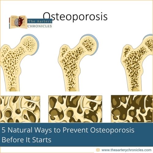 5-natural-ways-to-prevent-osteoporosis-before-it-starts-the-aartery-chronicles-tac