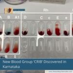 New Blood Group ‘CRIB’ Discovered in Karnataka