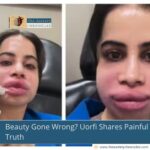 Beauty Gone Wrong? Uorfi Shares Painful Truth