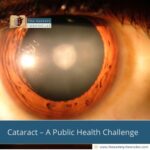 Cataract – A-Public-Health-Challenge-The-Aartery-Chronicles-TAC