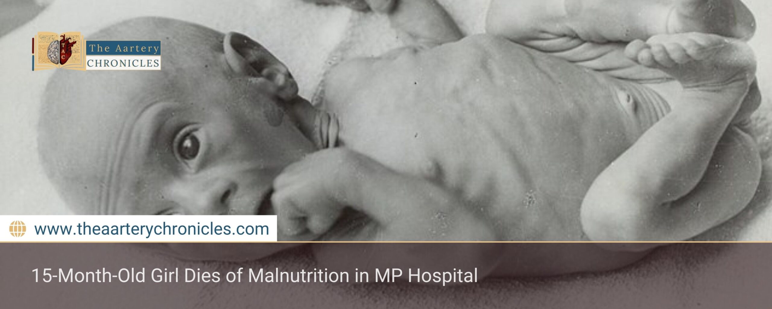 15-Month-Old Girl Dies of Malnutrition in MP Hospital