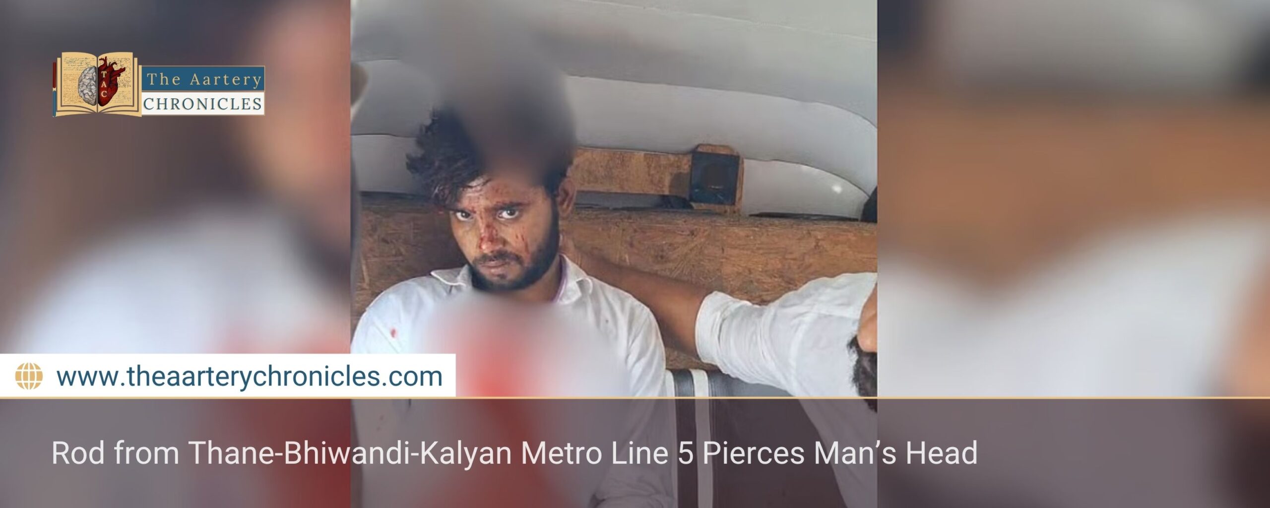Rod from Thane-Bhiwandi-Kalyan Metro Line 5 Pierces Man’s Head