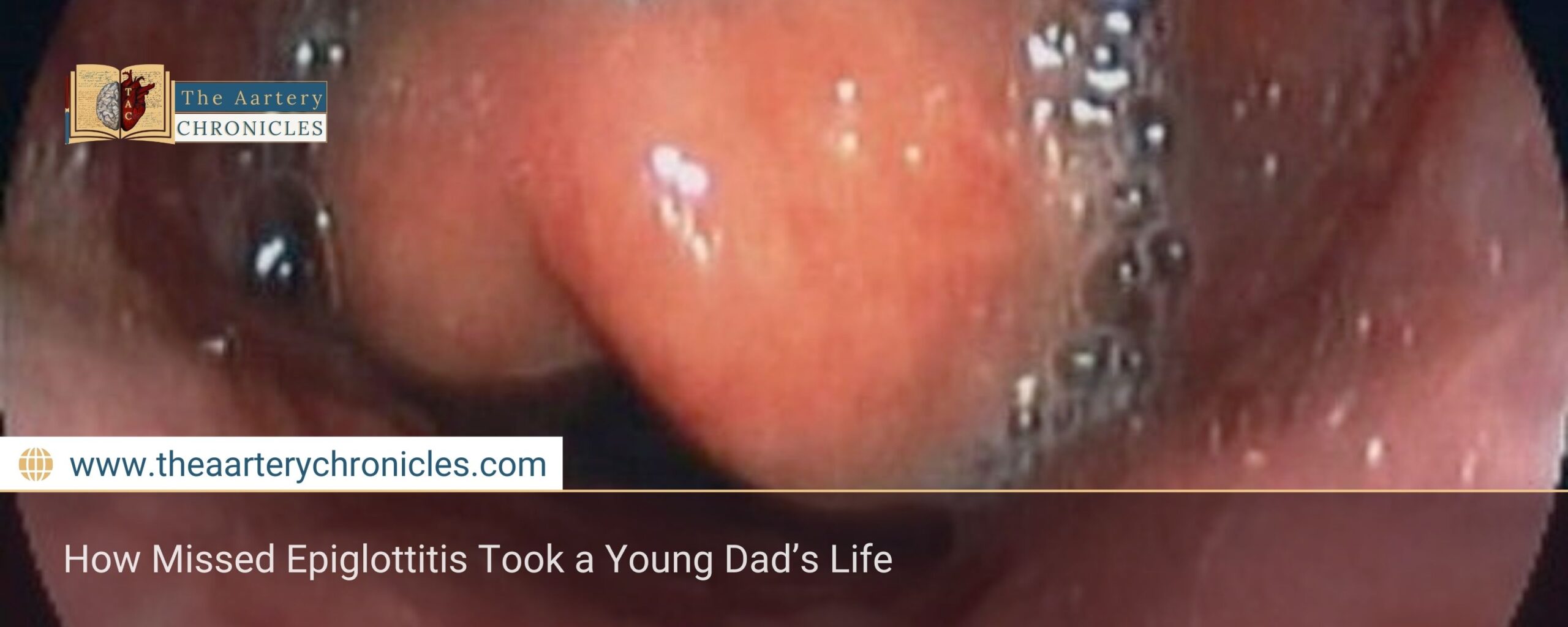 How Missed Epiglottitis Took a Young Dad’s Life