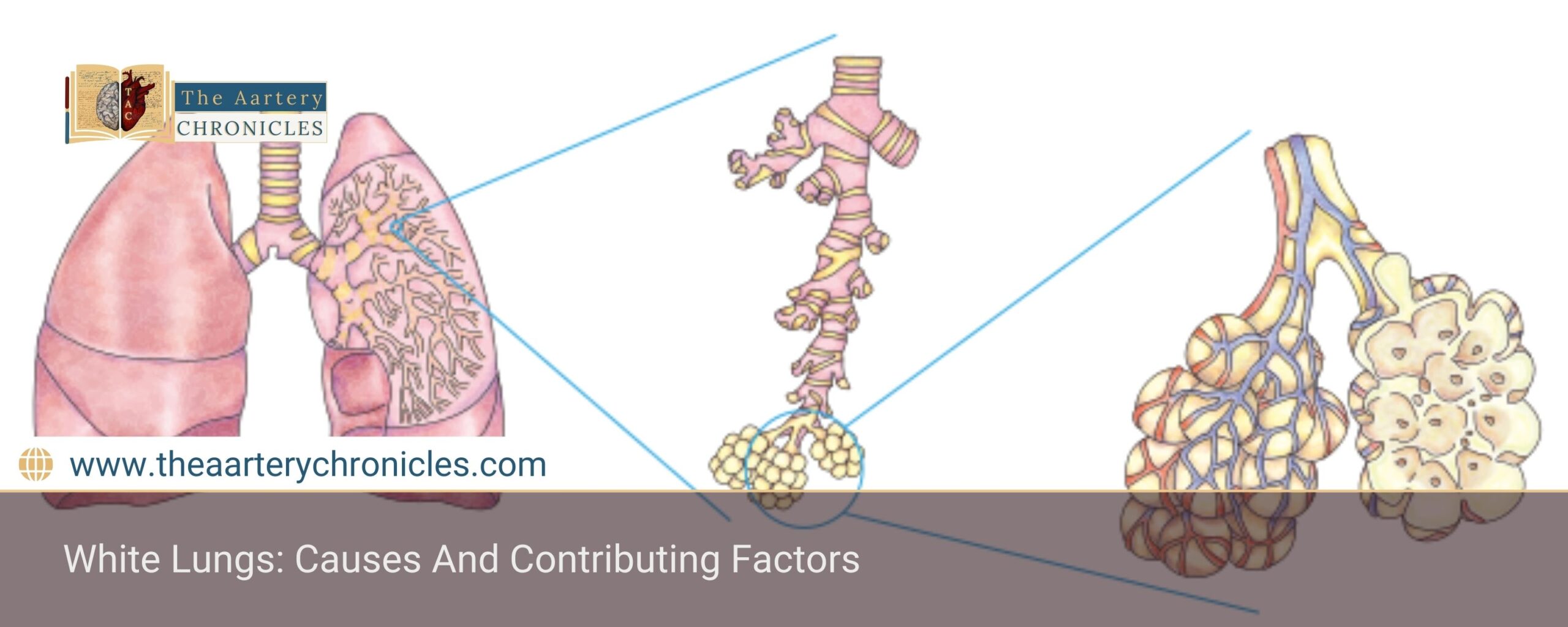 White-Lungs:-Causes-And-Contributing-Factors-The-Aartery-Chronicles-TAC
