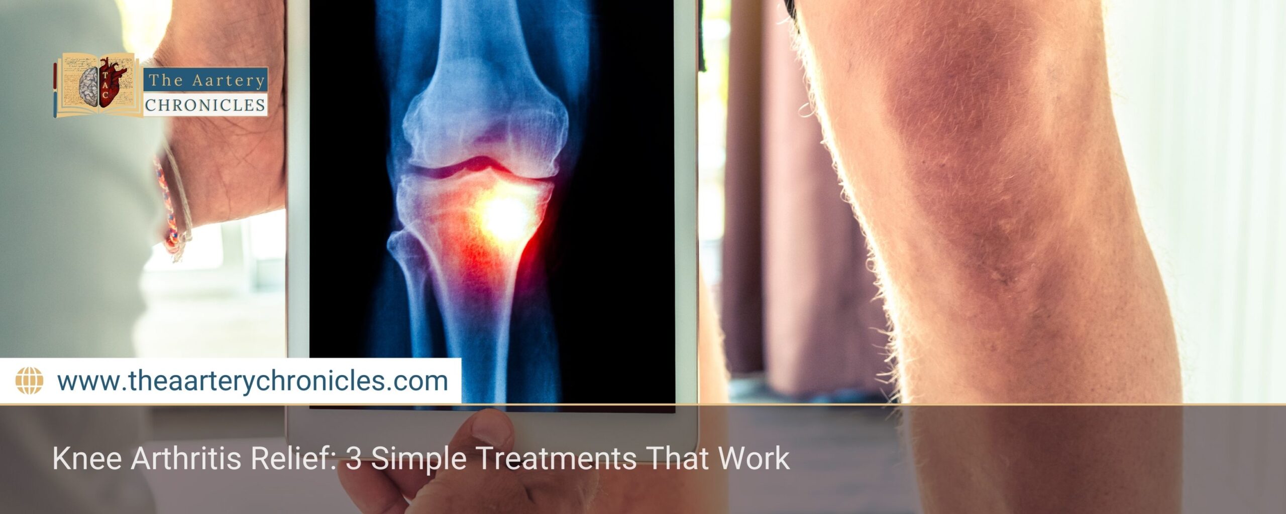 say-goodbye-to-knee-arthritis-pain-3-simple-solutions-the-aartery-chronicles-tac
