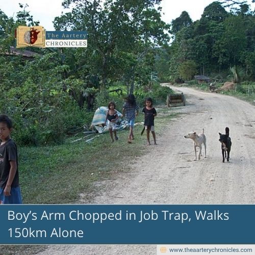 Boy’s Arm Chopped in Job Trap, Walks 150km Alone