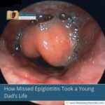 How Missed Epiglottitis Took a Young Dad’s Life