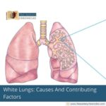 White-Lungs:-Causes-And-Contributing-Factors-The-Aartery-Chronicles-TAC