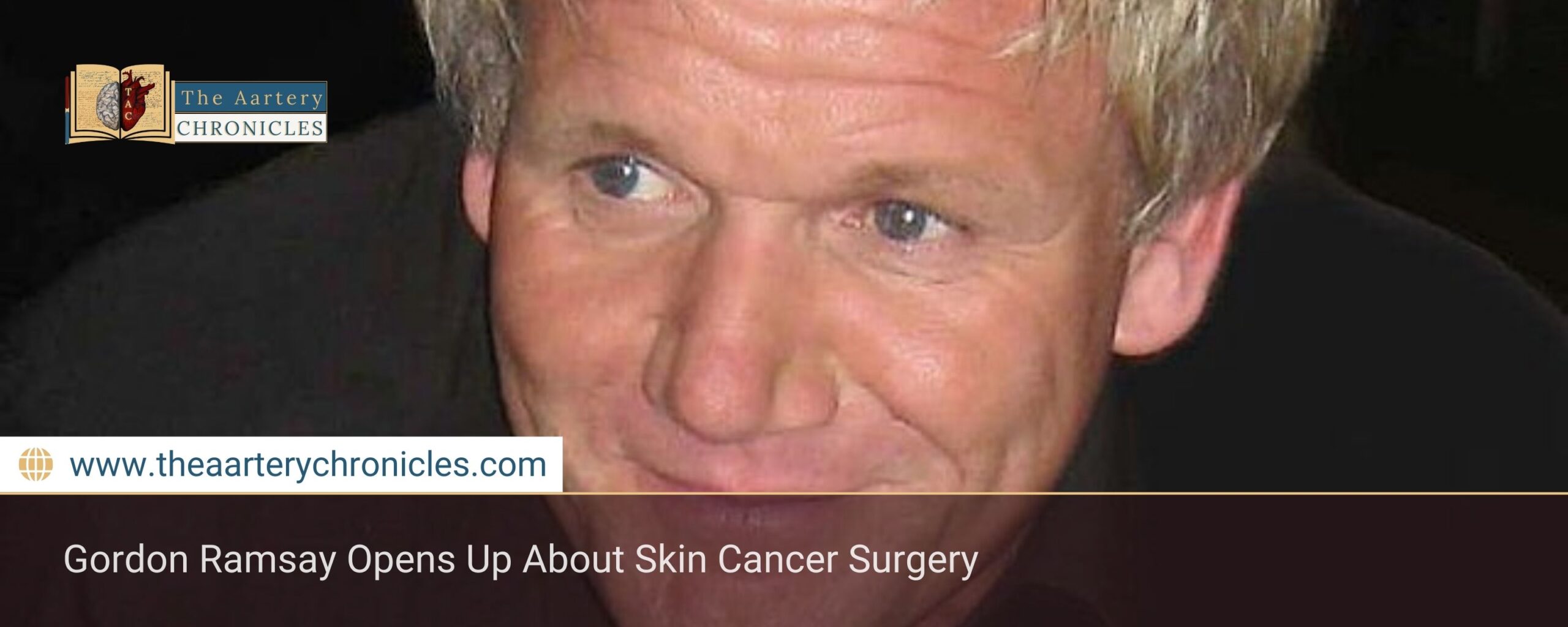 Gordon Ramsay Opens Up About Skin Cancer Surgery