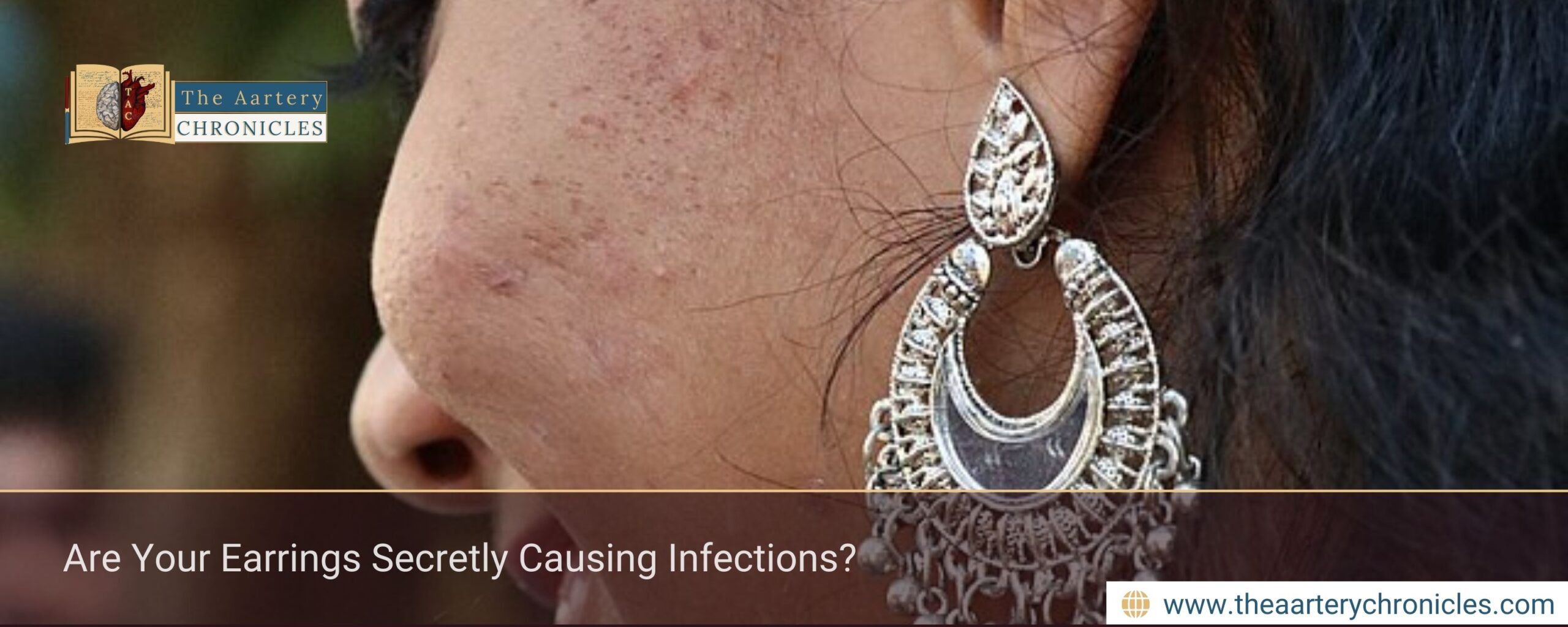 Are Your Earrings Secretly Causing Infections?