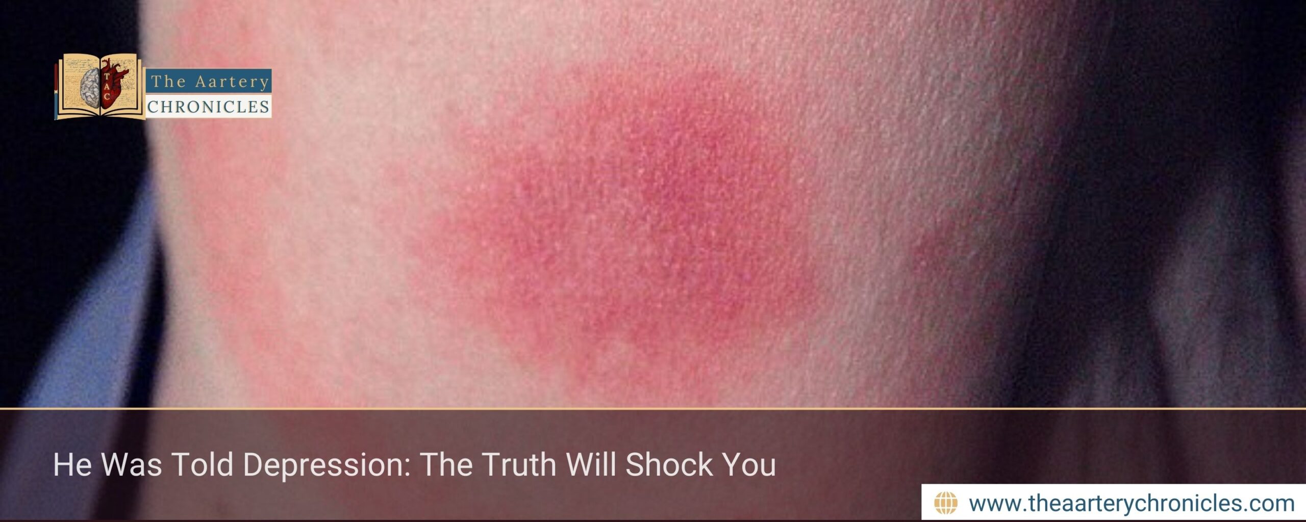 He Was Told Depression: The Truth Will Shock You