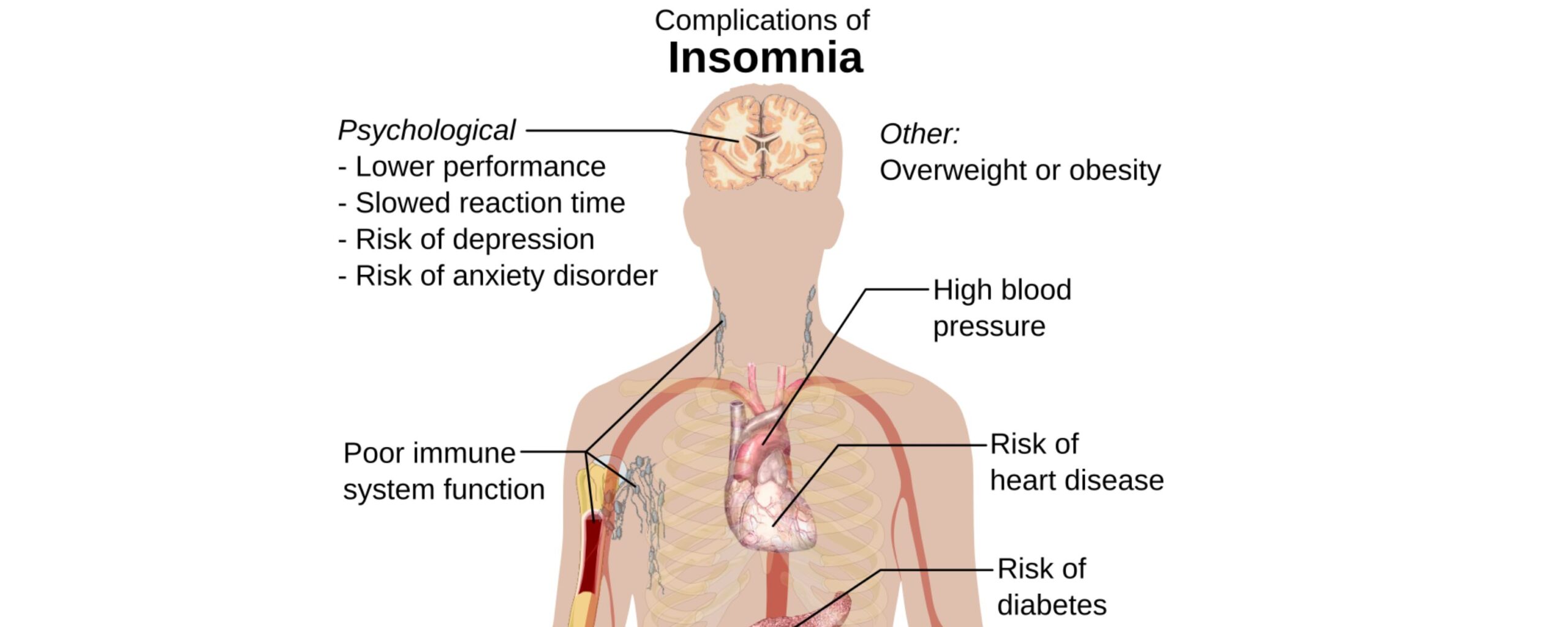 Sleep-is-the-Honest-Mirror-of-a-Fractured-Mind:-Insomnia-as-a-Public-Symptom-The-Aartery-Chronicles-TAC