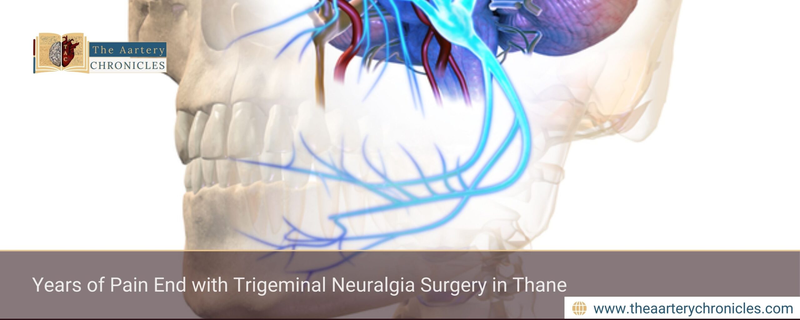Years of Pain End with Trigeminal Neuralgia Surgery in Thane