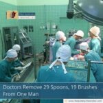 Doctors Remove 29 Spoons, 19 Brushes From One Man
