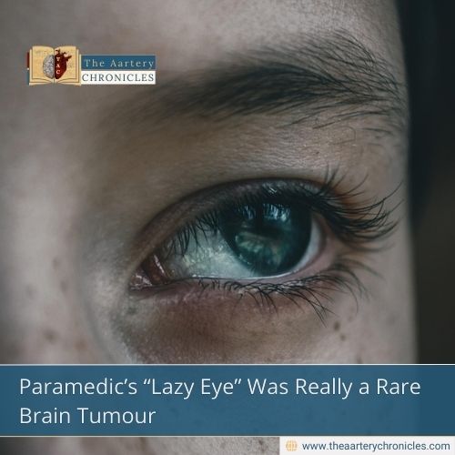Paramedic’s “Lazy Eye” Was Really a Rare Brain Tumour
