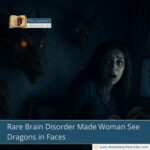 Rare Brain Disorder Made Woman See Dragons in Faces