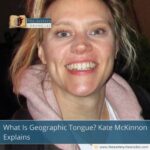 What Is Geographic Tongue? Kate McKinnon Explains