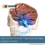 Years of Pain End with Trigeminal Neuralgia Surgery in Thane
