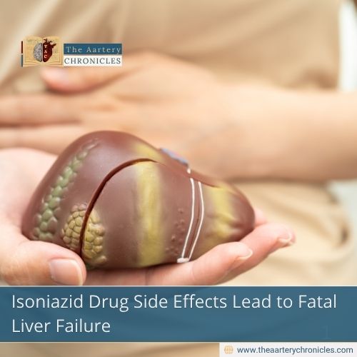 Isoniazid Drug Side Effects Lead to Fatal Liver Failure