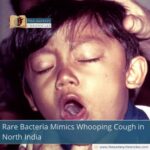 Rare Bacteria Mimics Whooping Cough in North India