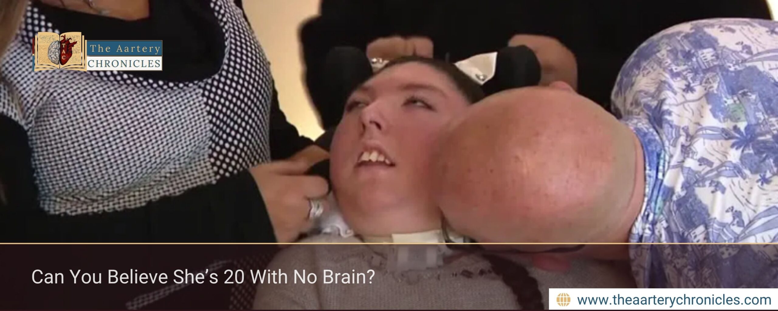 Can You Believe She’s 20 With No Brain?