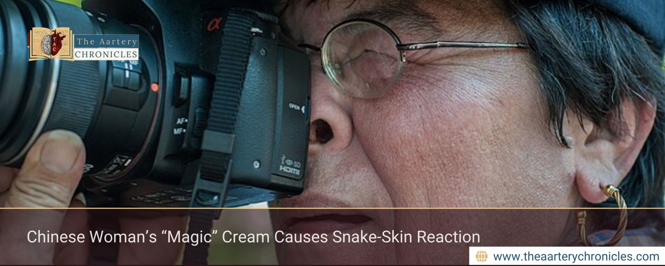 Chinese Woman’s “Magic” Cream Causes Snake-Skin Reaction