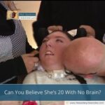 Can You Believe She’s 20 With No Brain?