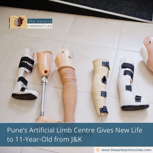 Pune’s Artificial Limb Centre Gives New Life to 11-Year-Old from J&K