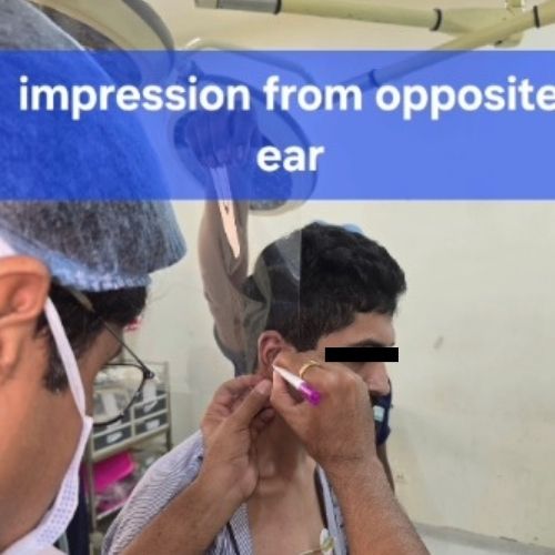 remarkable-recovery-after-ear-mutilation-by-human-bite-the-Aartery-Chronicles-TAC