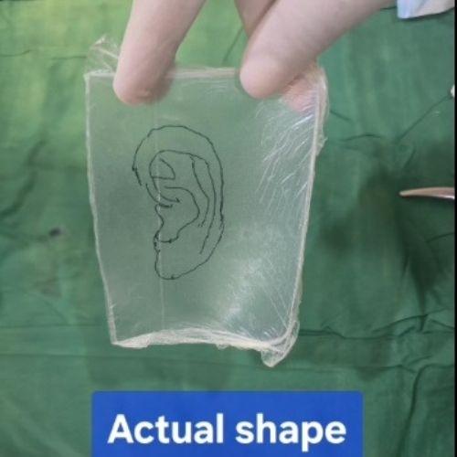 remarkable-recovery-after-ear-mutilation-by-human-bite-the-Aartery-Chronicles-TAC