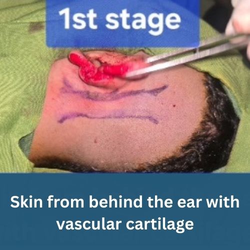 remarkable-recovery-after-ear-mutilation-by-human-bite-the-Aartery-Chronicles-TAC