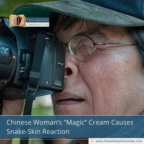 Chinese Woman’s “Magic” Cream Causes Snake-Skin Reaction
